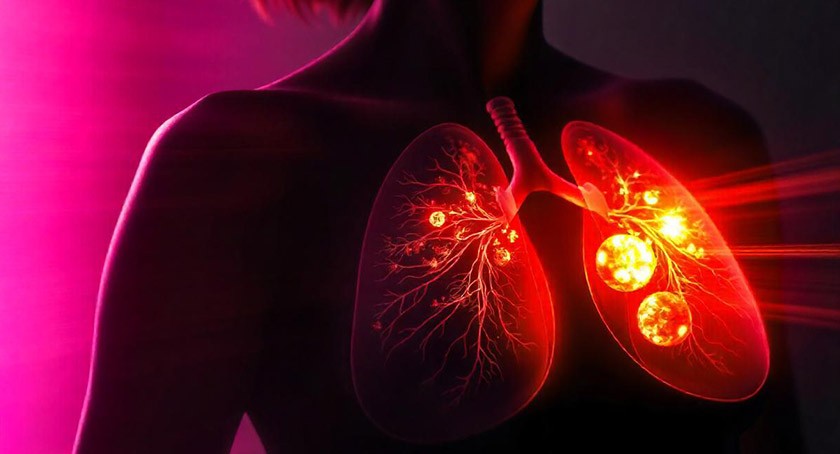 abbreviated case data